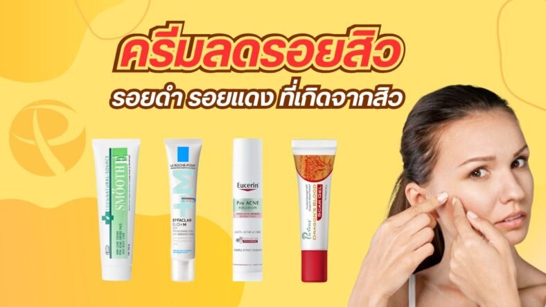 10 ครีมลดรอยสิว ยี่ห้อไหนดี 2025 ช่วยลดรอยแดง จุดด่างดำจากสิว ใช้แล้วเห็นผลจริง